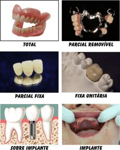 Pr Tese Em Odontologia Um Guia Medo De Dentista