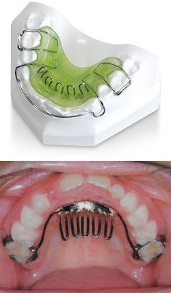 Pra Qu Serve A Grade Lingual Medo De Dentista Pra Qu Serve A Grade Lingual Medo De Dentista